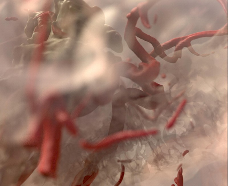 Gestaltete MRT- & CT-Daten (Hirnstamm, Arterien, Knochen), Zoom.
