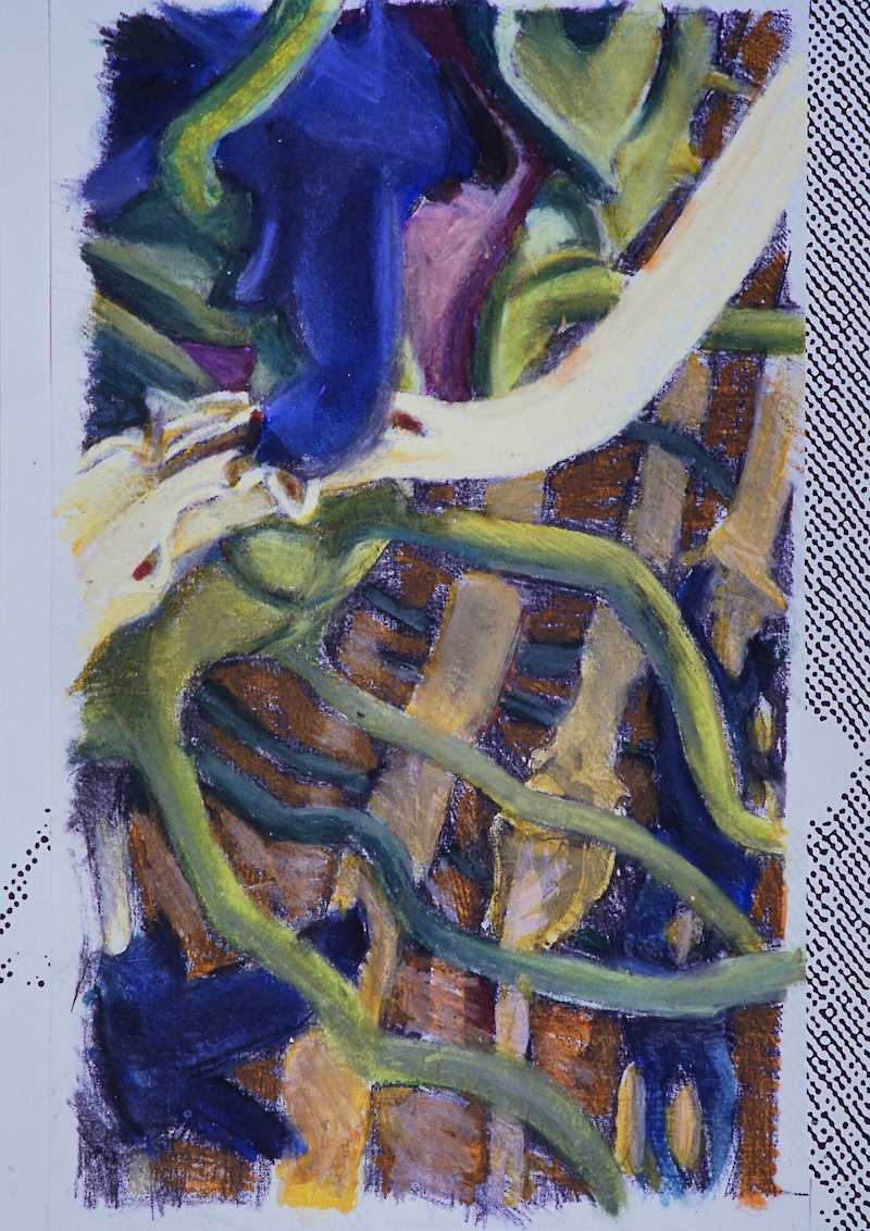 Multiple Sklerose