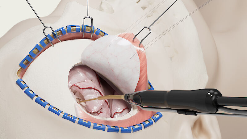 Lokalisation: Anatomische Lage des Eingriffes.