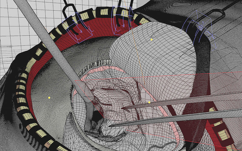 Wireframe-Ansicht der Operationsszene.