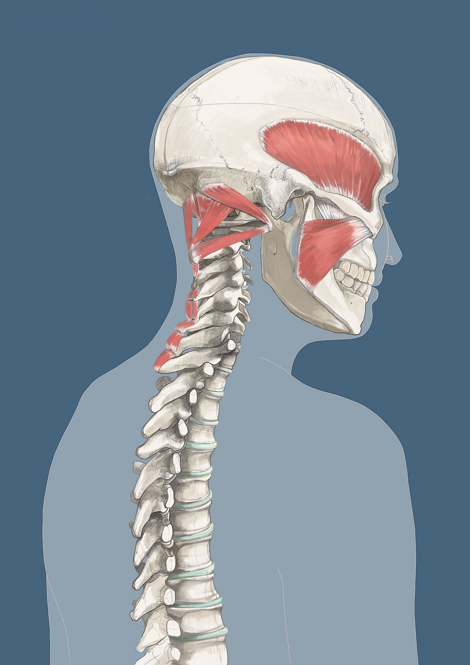 Vielschichtiges Schleudertrauma