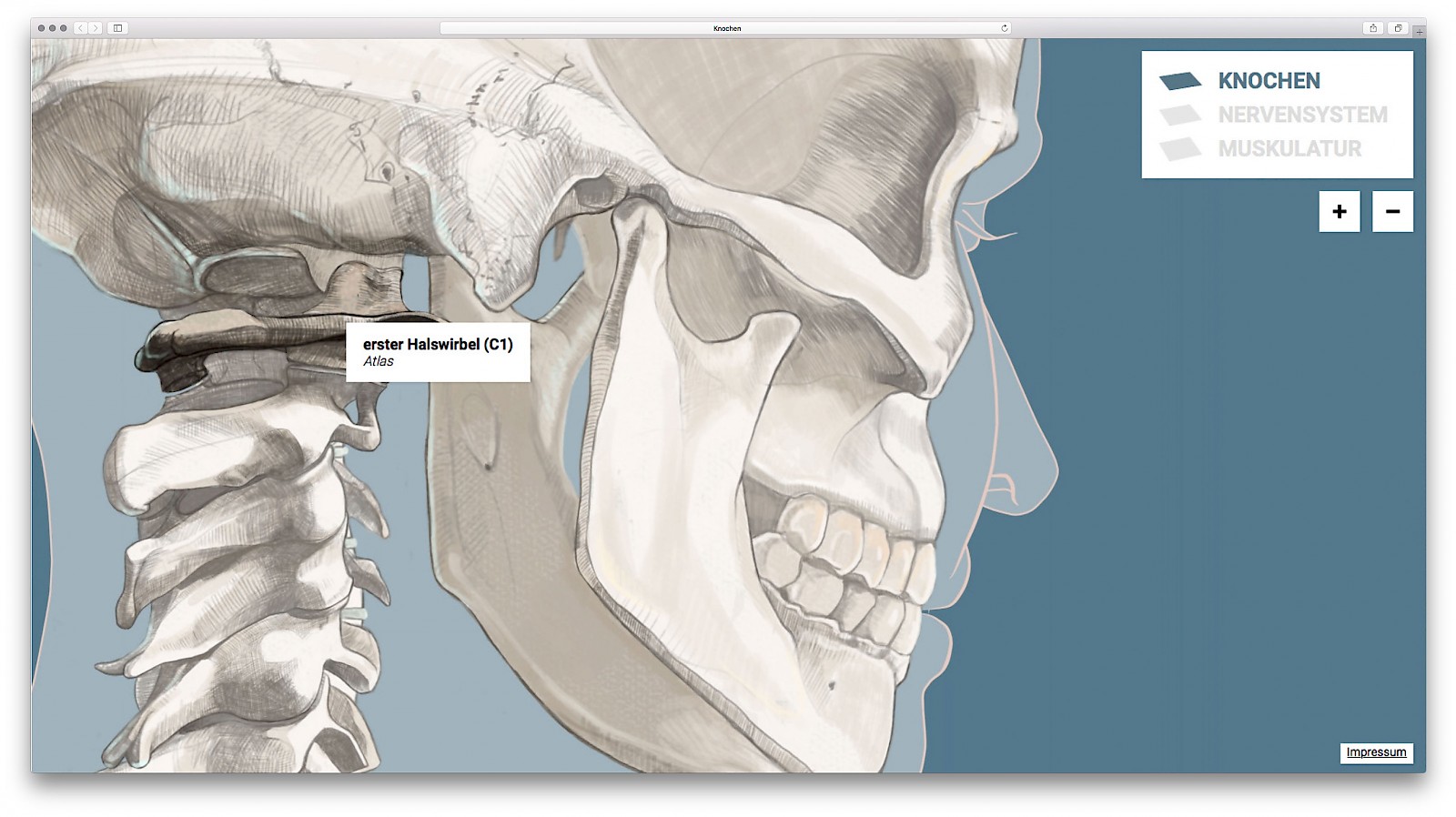 Vielschichtiges Schleudertrauma