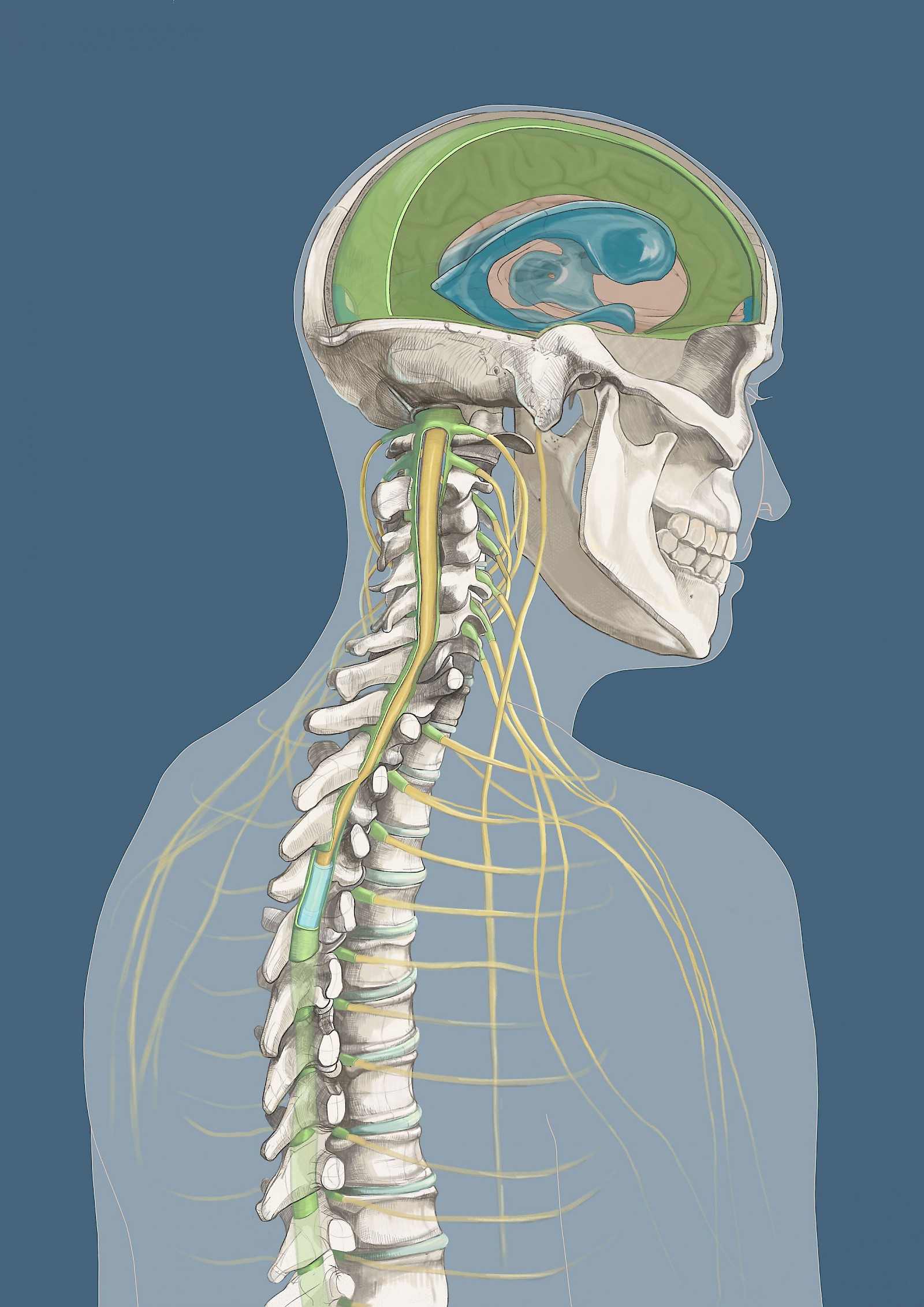 Vielschichtiges Schleudertrauma