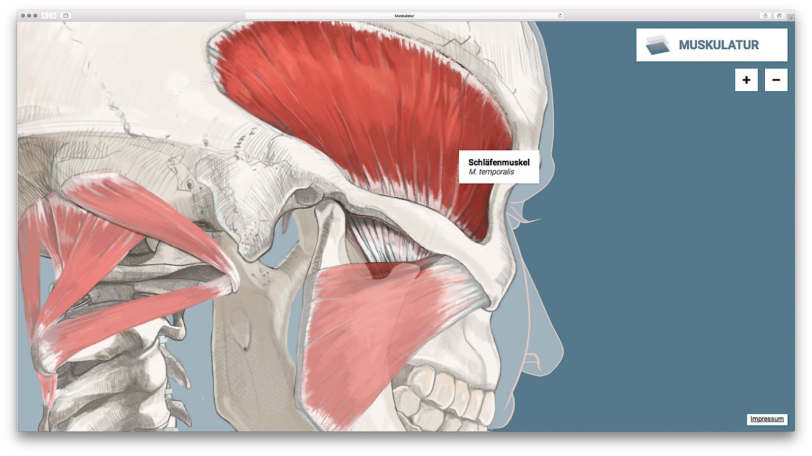 Vielschichtiges Schleudertrauma