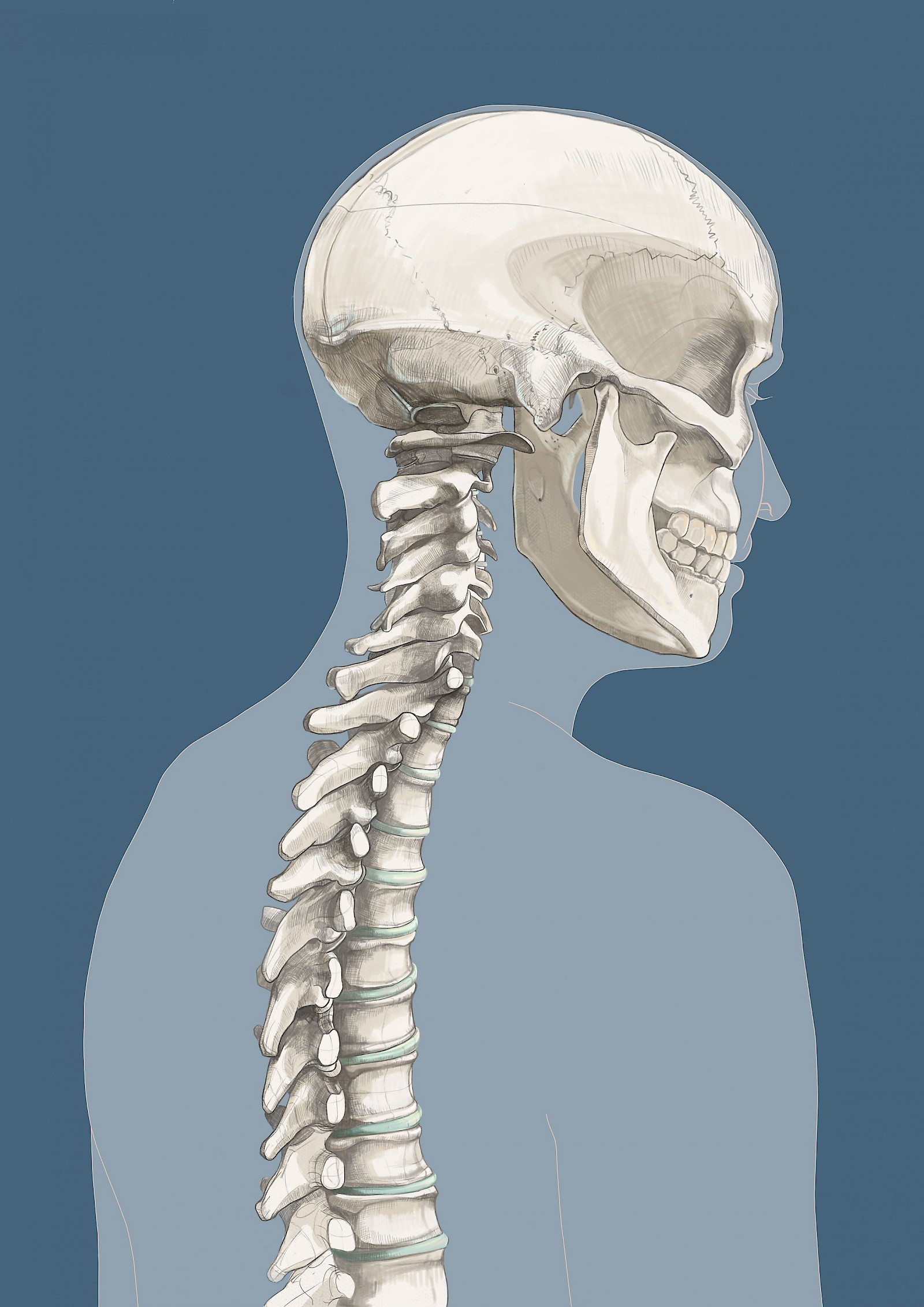 Vielschichtiges Schleudertrauma