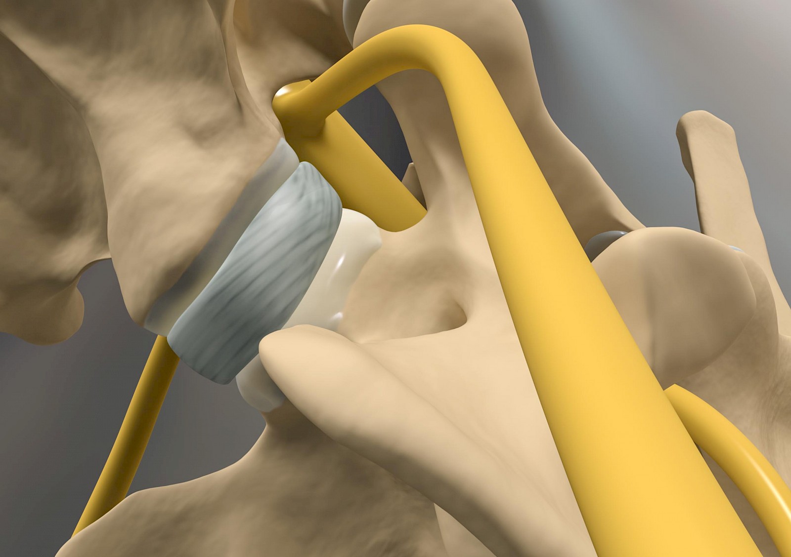 Das Canine-Wobbler-Syndrom