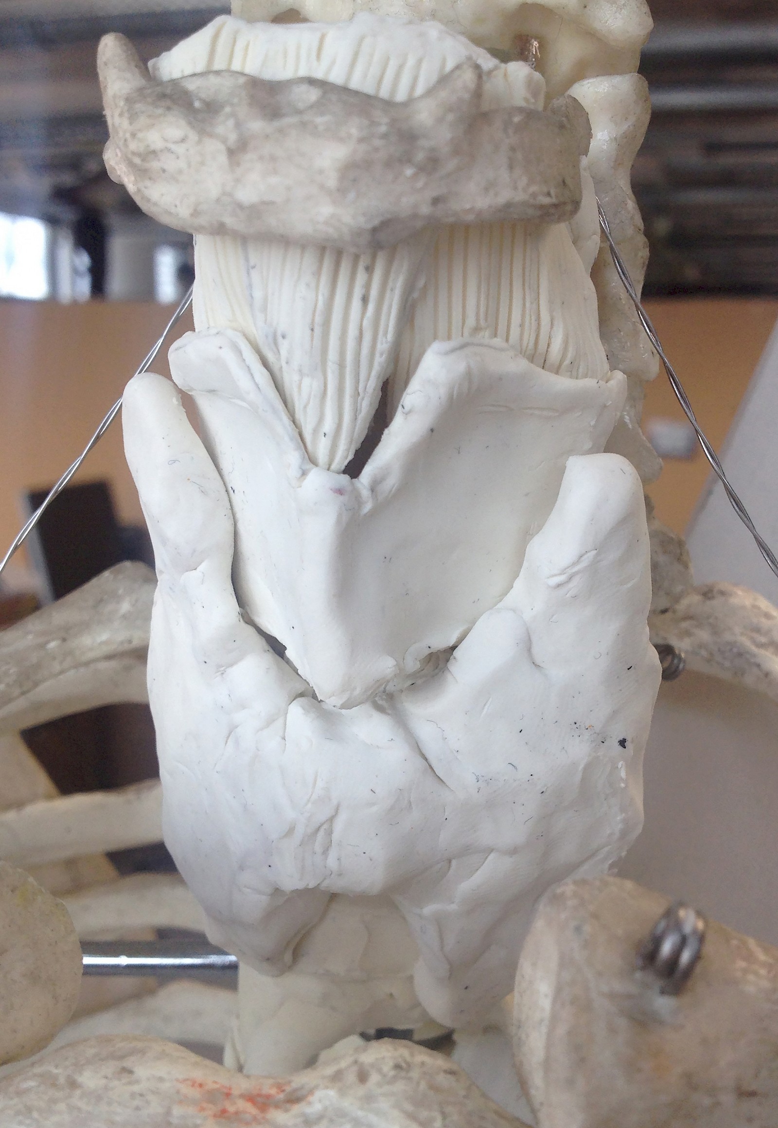 Die Schilddrüse ist im unteren Halsbereich unterhalb der Kehlkopfes lokalisiert. Durch eine Brücke (Isthmus) zwischen den beiden Schilddrüsenlappen entsteht die Form eines „H“.Merkbild Hypothyreose Die Darstellung zeigt typische Symptome einer Schilddrüsenunterfunktion wie verminderten Appetit, Müdigkeit, Übergewicht und einen verlangsamten Herzschlag (Bradykardie).