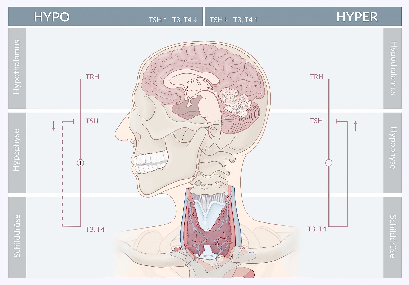 Pathophysiologischer Feedback-Mechanismus von Hypo- und Hyperthyreose: Die Schilddrüse ist im unteren Halsbereich unterhalb der Kehlkopfes lokalisiert. Durch eine Brücke (Isthmus) zwischen den beiden Schilddrüsenlappen entsteht die Form eines „H“. Die Hormone, die die Funktion der Schilddrüse steuern, unterliegen einem Regelkreis (Hypothalamus-Hypophyse-Schilddrüse). Je nach Hormonkonzentration in der Schilddrüse (T3/T4) wird die Ausschüttung von TSH in der Hypophyse durch einen Feedback-Mechanismus reguliert.