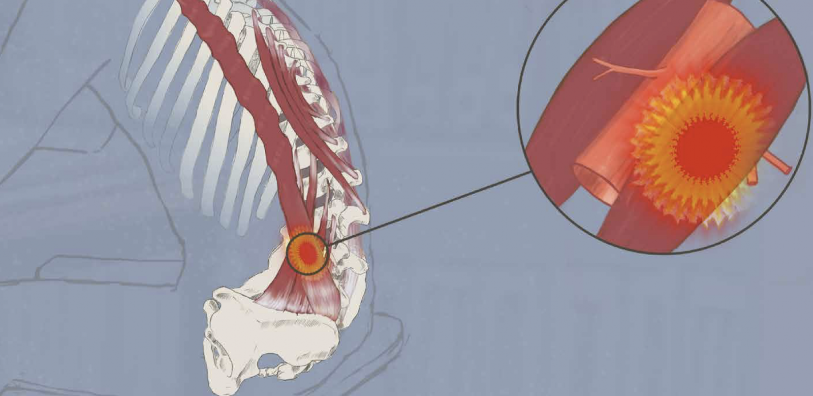 Im Film werden mehrere Ebenen angesprochen: Während sich der Betrachter zu Beginn durch eine alltägliche Szene mit der Figur identifizieren kann, wird die Szene zum Hintergrund, wenn komplexe Vorgänge im Körper dargestellt werden. Durch die einheitliche Farbgebung und den Zeichenstil entsteht dennoch eine durchgängige Bildsprache, die zu einem harmonischen Endergebnis führt.