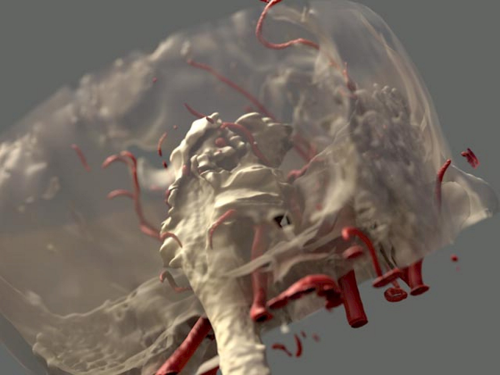 Gestaltete MRT- & CT-Daten (Hirnstamm, Arterien, Knochen), OP-Situs/ Zoom.