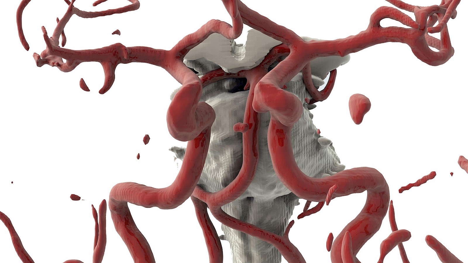 Gestaltete MRT- & CT-Daten (Hirnstamm, Arterien), Zoom.