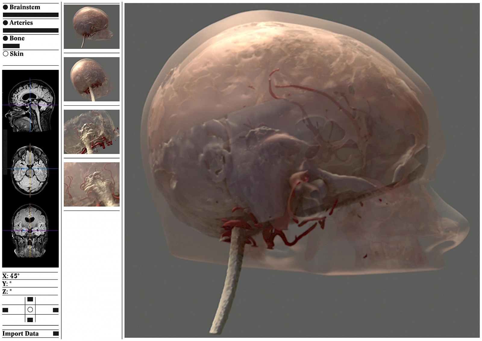 Prototyp-Applikation, Variante Benutzeroberfläche