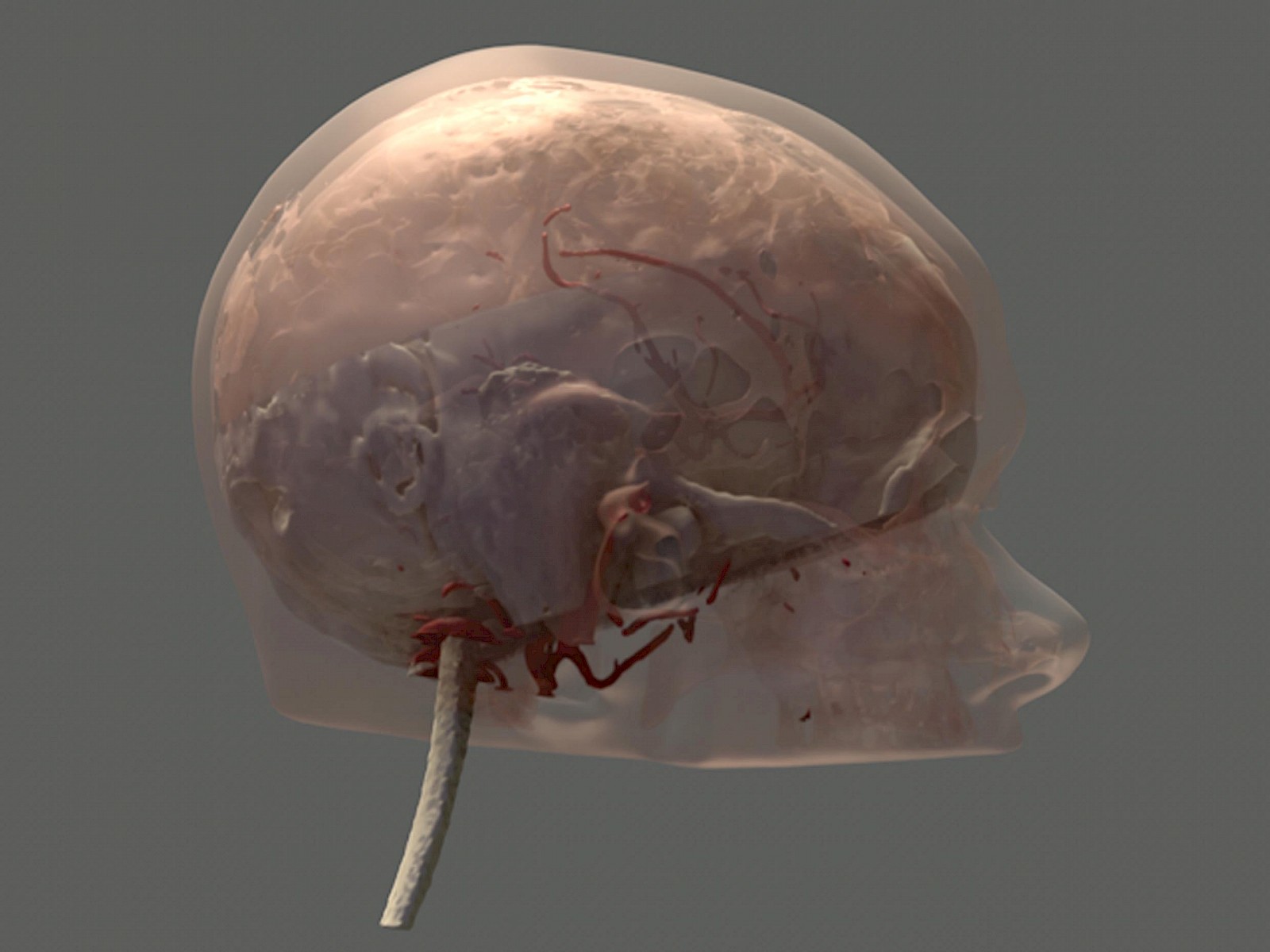 Gestaltete MRT- & CT-Daten (Hirnstamm, Arterien, Knochen und Schädelumriss), Seitenansicht Patient.