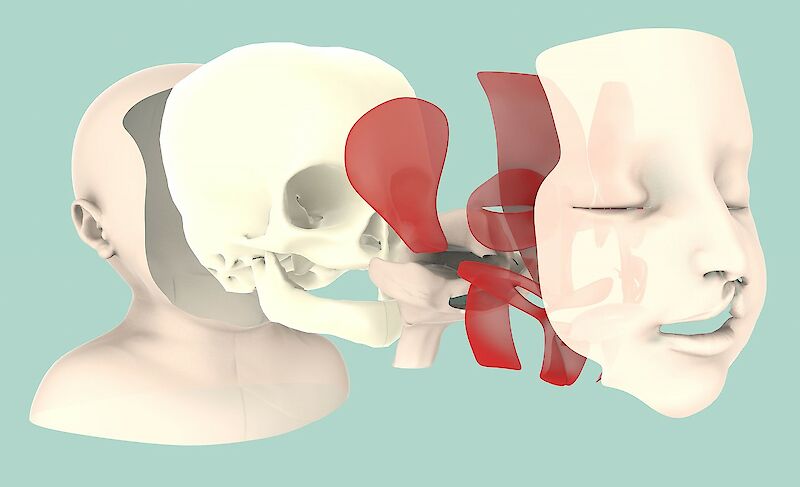 Entwicklung eines Lehrmittels das Kompetenzaufbau angehender Chirurginnen und Chirurgen in der Fachdisziplin der Spaltchirurgie unterstützen soll.