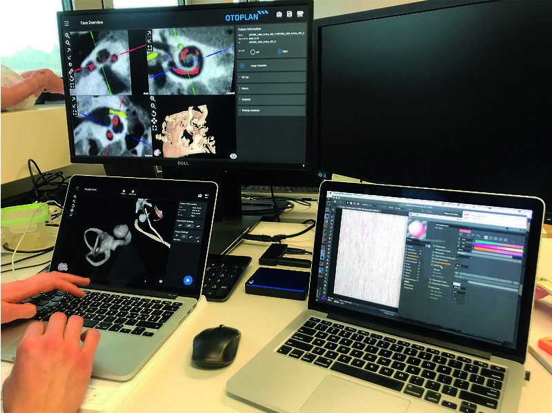 Using Cinema 4D, various visual themes are created. Models are shared using Sketch- fab to test the ability of the visualizations to improve accuracy of identifying structures and ability to orient structures.