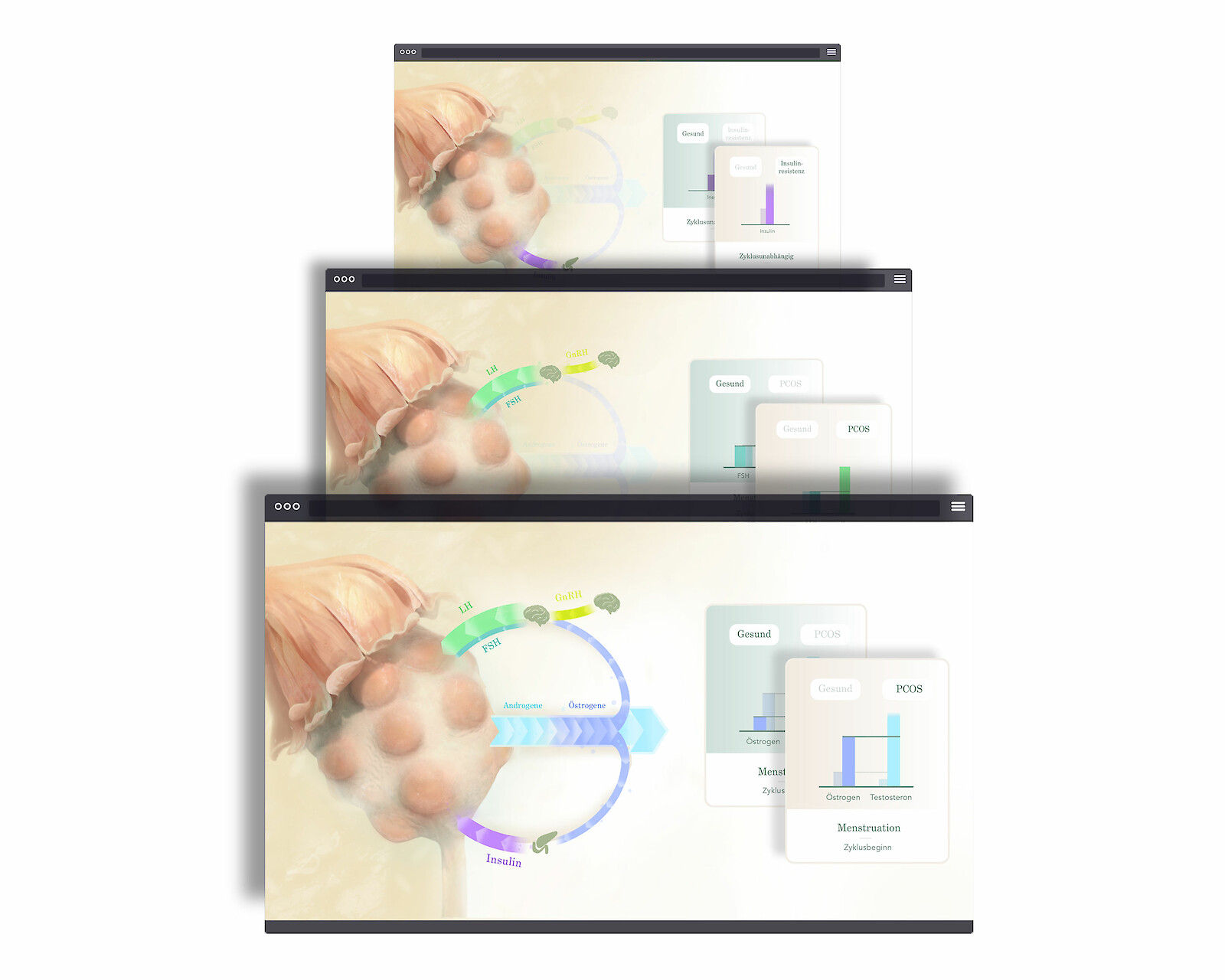Der Hormonkreislauf des Polyzystischen Ovarsyndroms