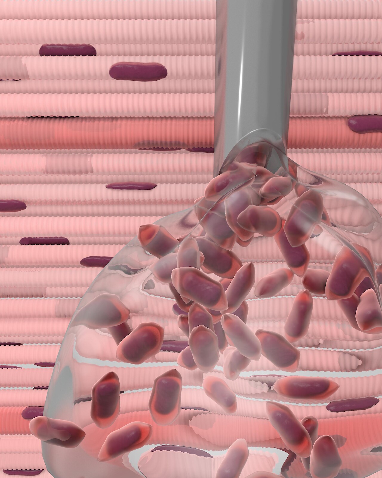 Tina Schwendener, Muskelstammzellen gegen Blaseninkontinenz: «Stammzellen werden zusammen mit Kollagen eingespritzt.»