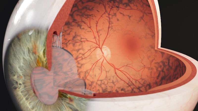 Visible Vision