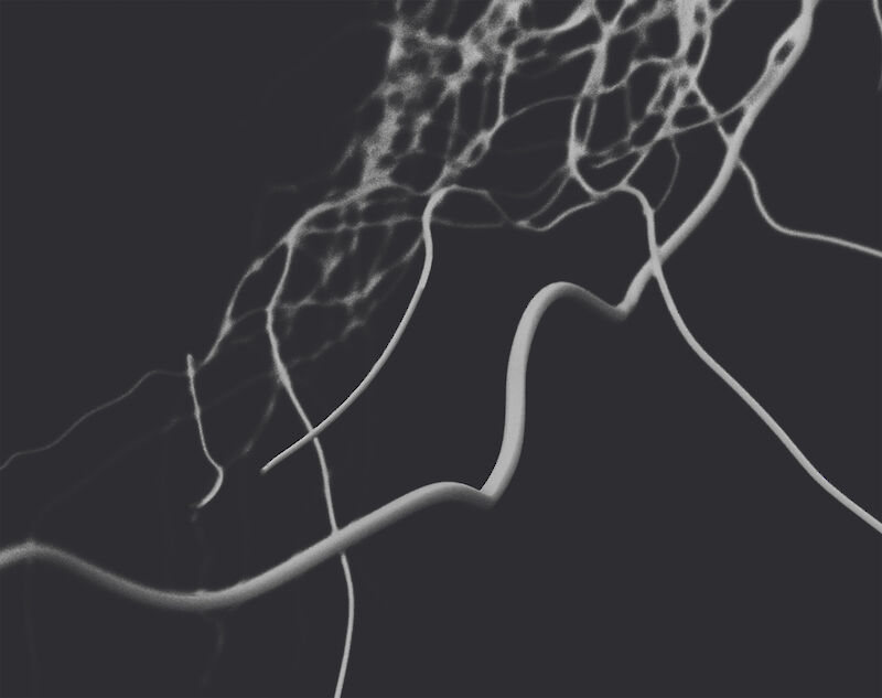 Vessels. Stimmungserfassung und Erprobung von Unschärfe in der Welt der Kleinstgefässe – Auf Englisch «Vessels» genannt. Modelliert und gerendert in Blender.