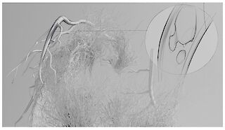 Stilerprobung. Erste Zugabe von Skizze zum 3D-Objekt. Mit Hilfslinien können wichtige Verortungen im Bild nochmals hervorgehoben und die Form verständlicher gestaltet werden.