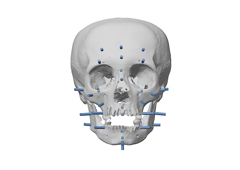 Das Setzen von sogenannten «Tissue Depth Markers» ist ein essenzieller Teil des Rekonstruierens. Diese zeigen an, wie viel Gewebe im Durchschnitt für spezifische Nationalitäten, Geschlechter und Alter auf dem Knochen liegen.
