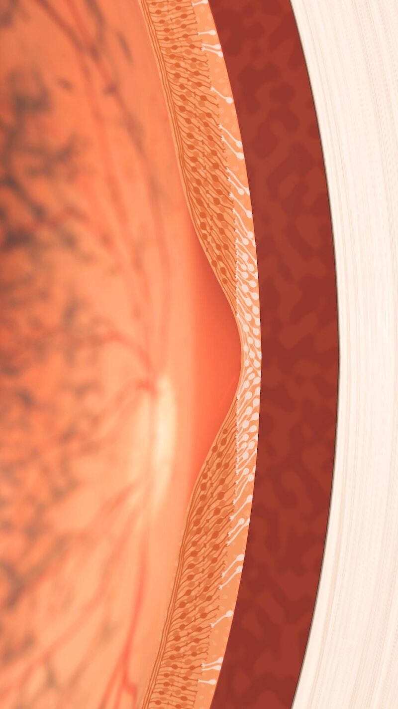Visible Vision