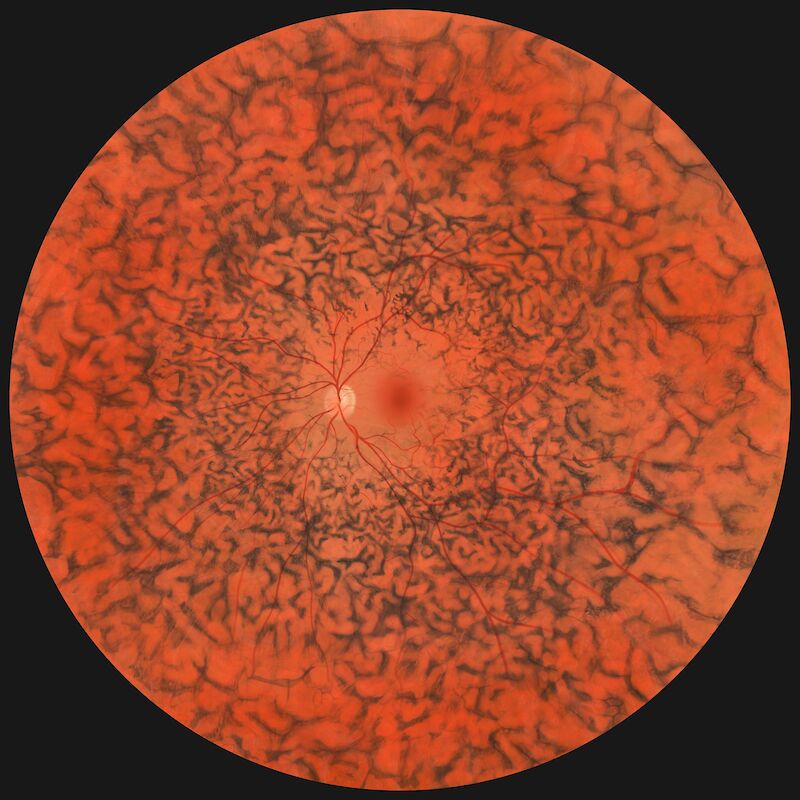 Visible Vision