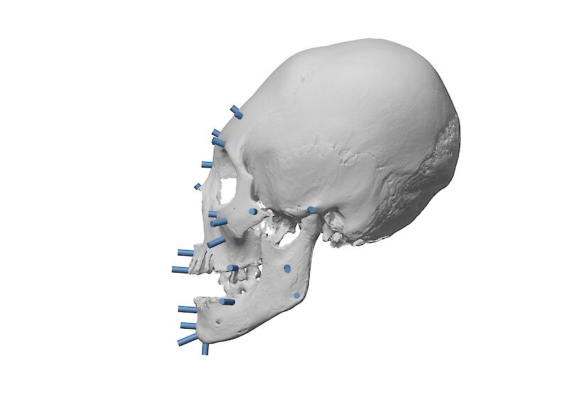 Das Setzen von sogenannten «Tissue Depth Markers» ist ein essenzieller Teil des Rekonstruierens. Diese zeigen an, wie viel Gewebe im Durchschnitt für spezifische Nationalitäten, Geschlechter und Alter auf dem Knochen liegen.