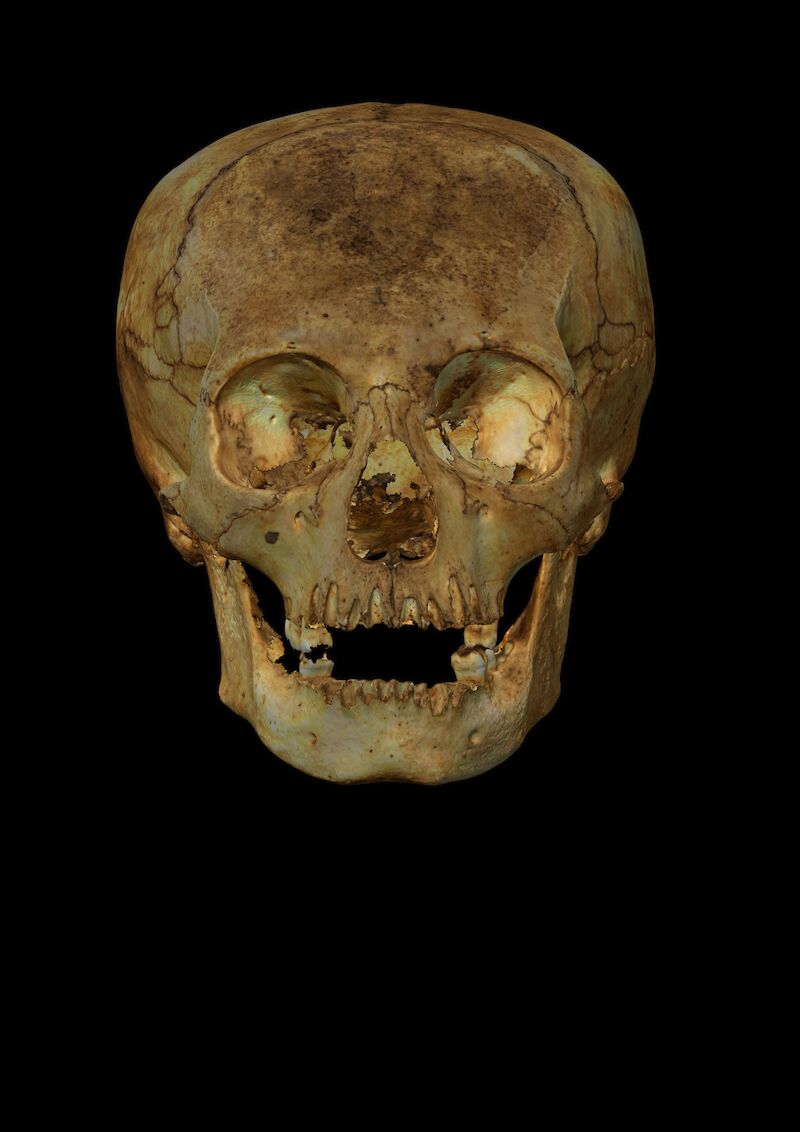 Ein, vermutlich, weiblicher Schädel aus der Vorkolonialzeit, gefunden in einer Höhle in Maisí, Kuba. Speziell ist die absichtliche Verformung des Schädels, welche im Laufe der Kindheit durchgeführt wurde.