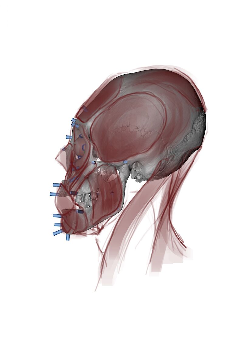 Skizzen der Gesichtsmuskulatur basierend auf dem Schädel, um die Anatomie besser verstehen zu können.