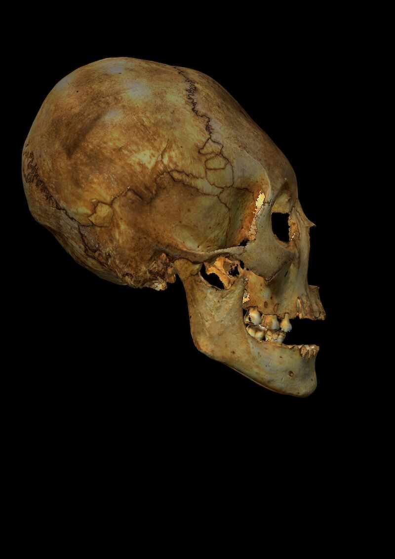 Ein, vermutlich, weiblicher Schädel aus der Vorkolonialzeit, gefunden in einer Höhle in Maisí, Kuba. Speziell ist die absichtliche Verformung des Schädels, welche im Laufe der Kindheit durchgeführt wurde.