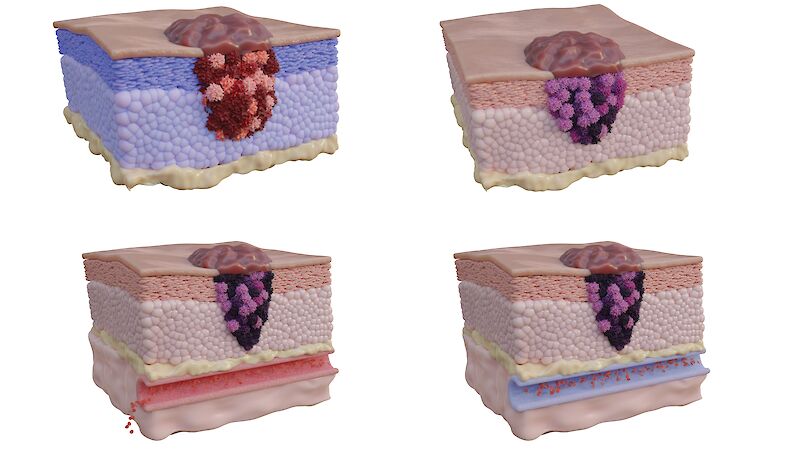 Creative variations of the skin section.