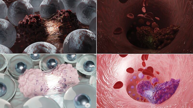 Preliminary 3D experiments of cancer-related visualization in ominous aesthetic (top) versus the alternative calm aesthetic (bottom).