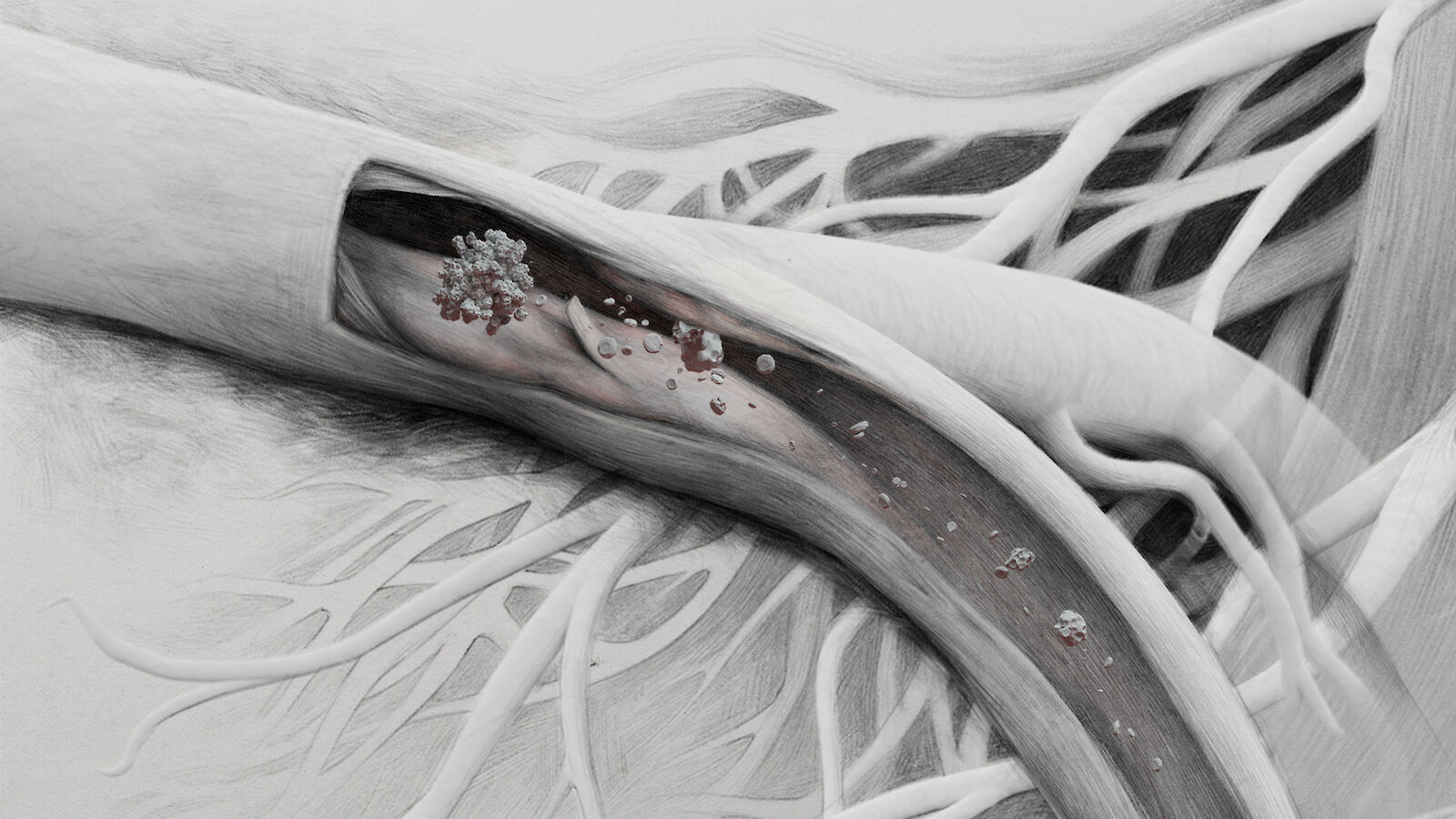 Ida Götz, Emboli und Obstruktion, 2023