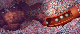 3D-Schnittdarstellung einer Lymphdrüse mit erkennbaren Tumorzellen und einem begleitenden Blutgefäss mit Einblick ins Innere.