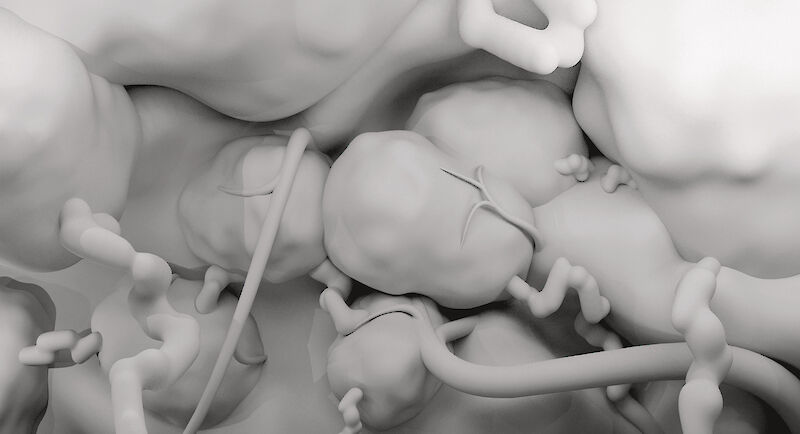 Modellansicht der erkrankten Lymphknotenstruktur im unkolorierten Zustand.