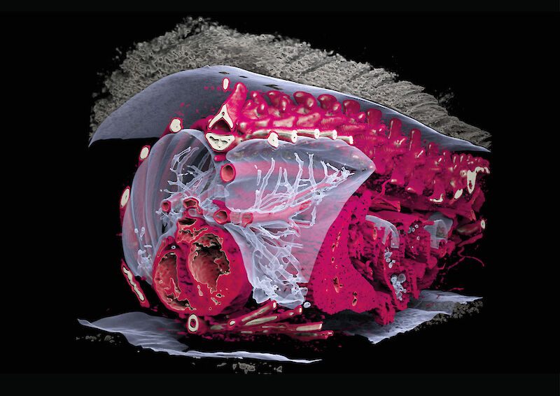 Prozessbild: CT-basiertes Volume Rendering. Die Lunge wird transparent dargestellt, um Gefäße und Bronchien sichtbar zu machen, inklusive Schnitt mit Einblick in die Herzkammern.