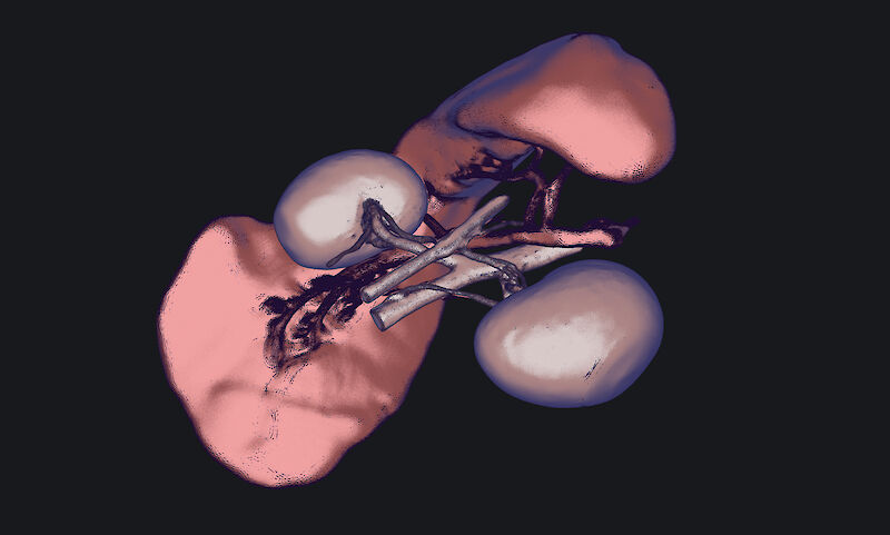 Prozessbild. Experimente in Spline 3D: Toon- und Outline-Stil zur räumlichen Erprobung. Fokus auf Niere und Milz.